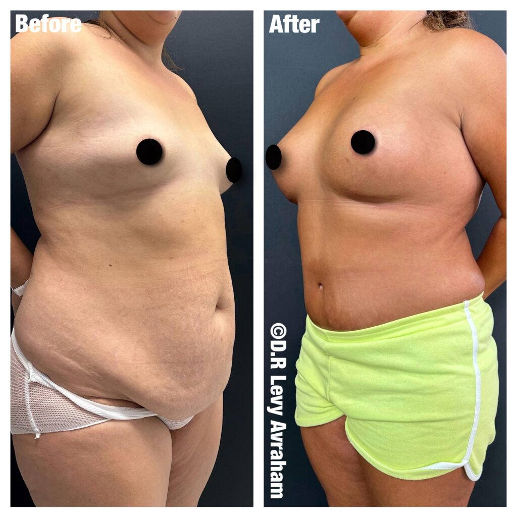 מאמי מייקראובר