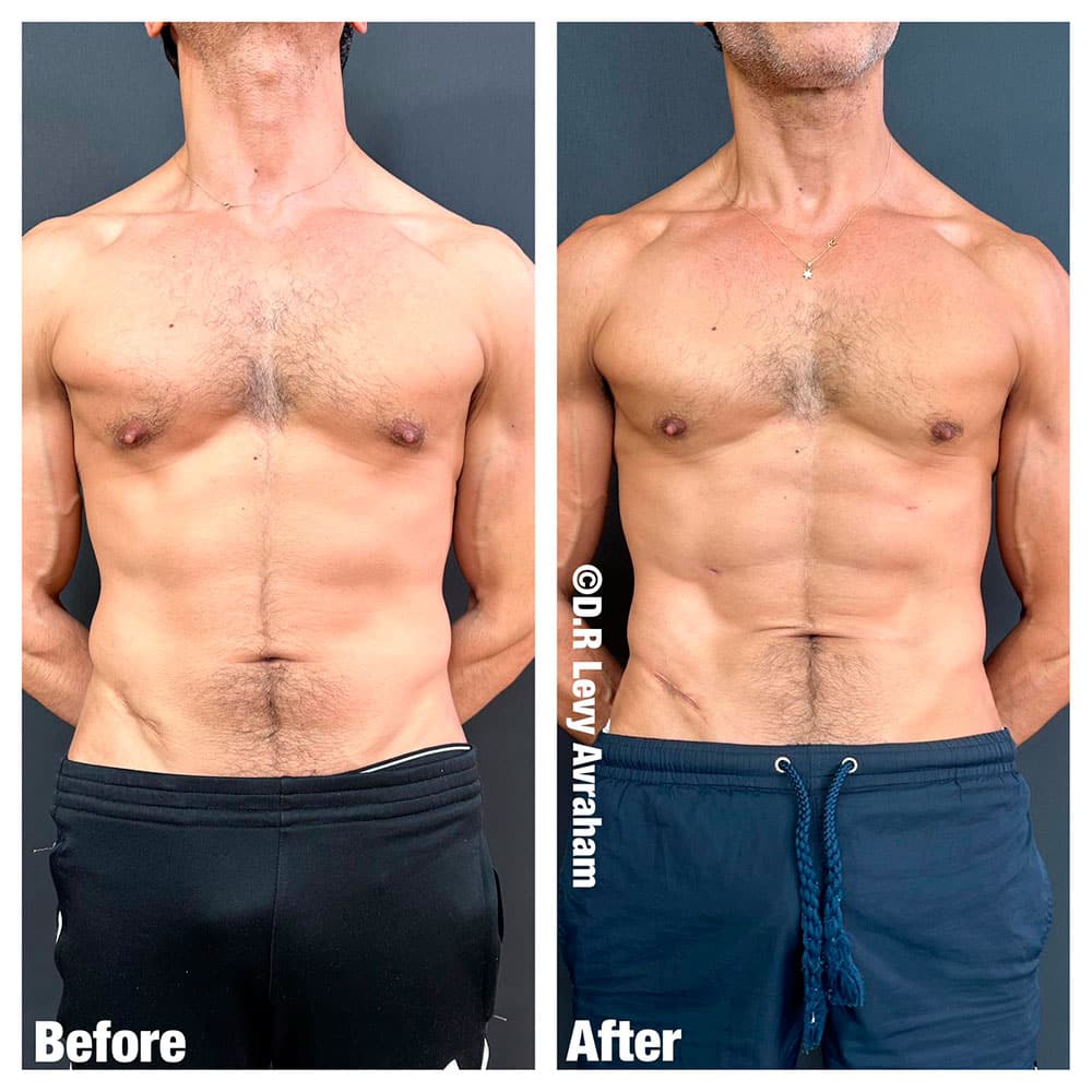 עיצוב קוביות בבטן