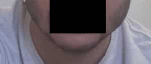 עיצוב קו לסת לגבר