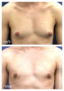 גניקומסטיה ד"ר לוי אברהם