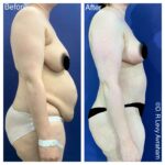 מאמי מייקראובר