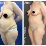 מאמי מייקראובר