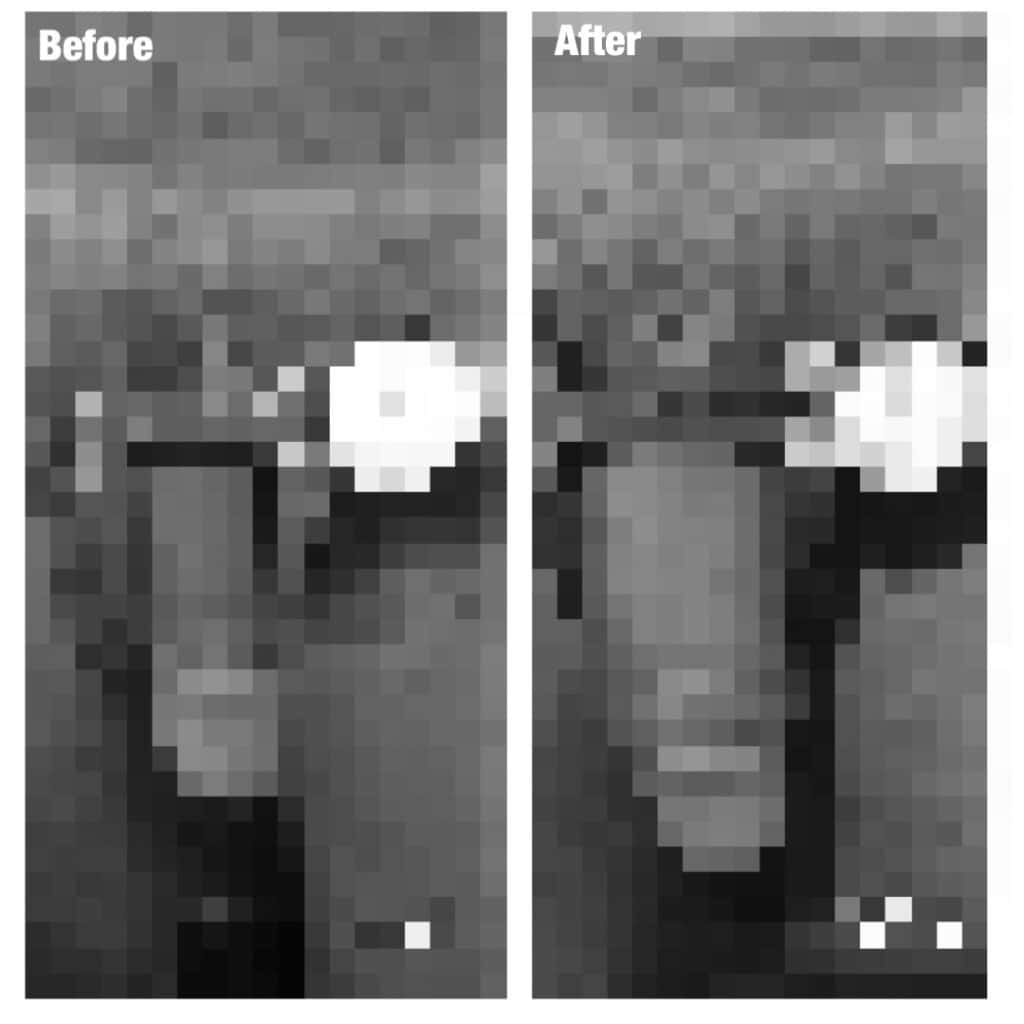 עיבוי פין - הגדלת איבר המין