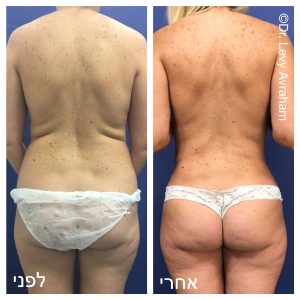 עיצוב של הישבן