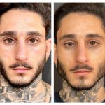 עיצוב קו לסת גברים